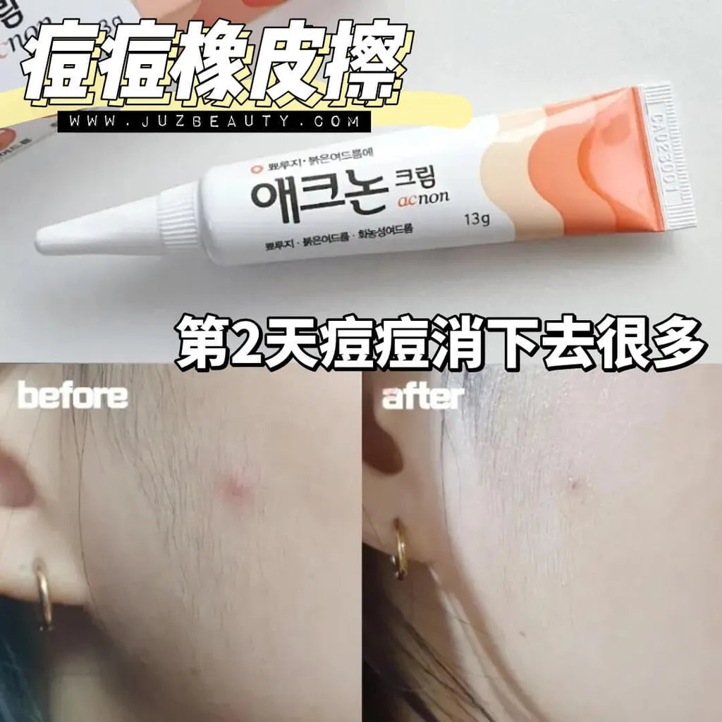 Dong-A Acnon Cream 13g