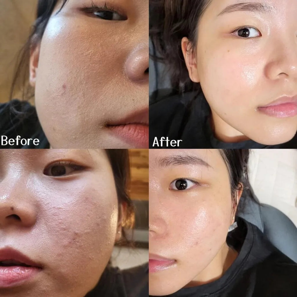 Dong-A Aclean Gel 20g