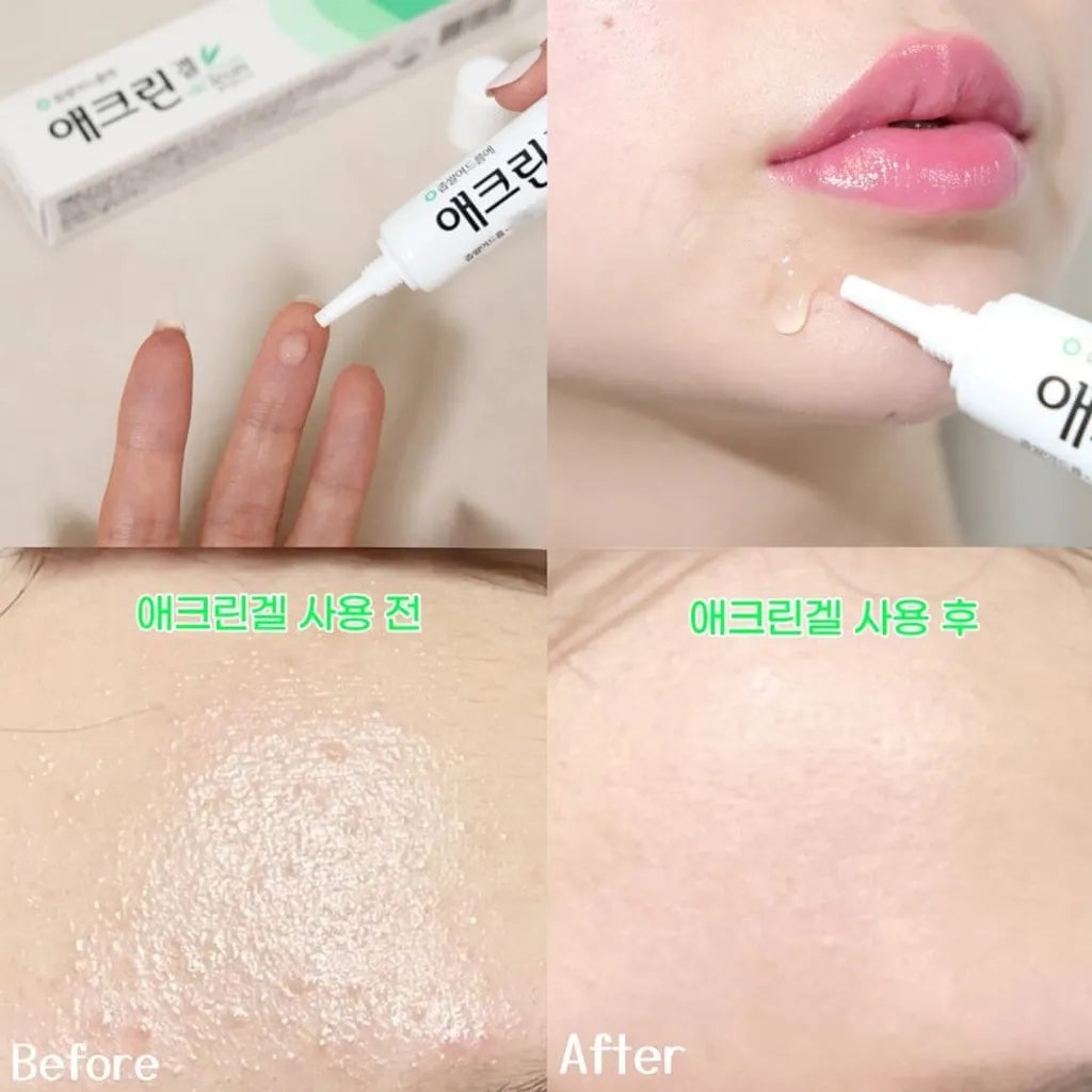 Dong-A Aclean Gel 20g